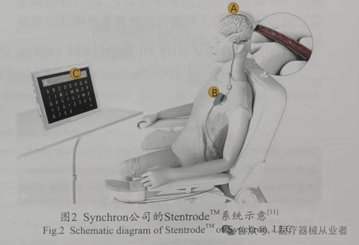 脑机接口(医疗康复应用)(脑机接口的原理与应用)