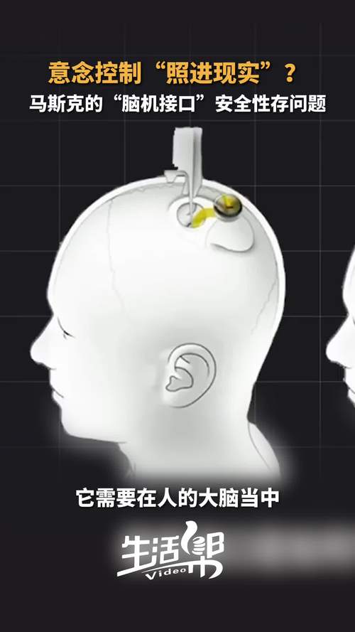 脑机接口的伦理红线(脑机接口的意义)
