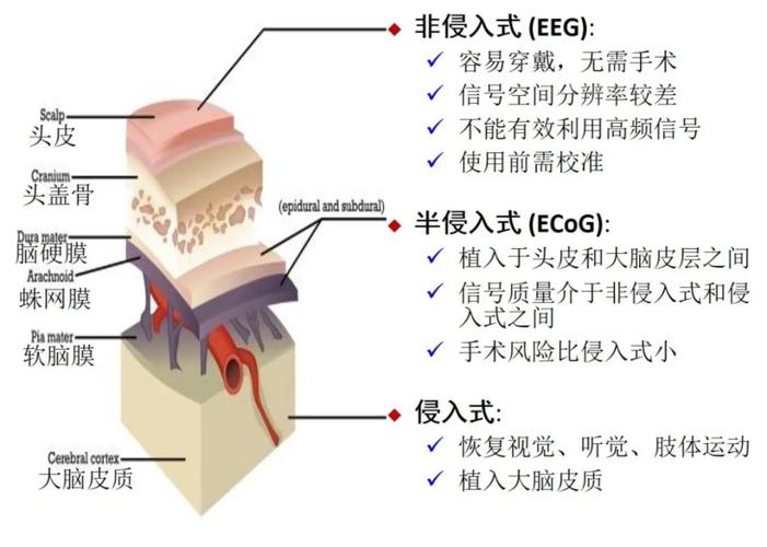 脑机接口的伦理红线(脑机接口的意义)