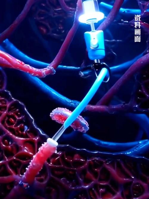 纳米机器人生殖隔离(纳米机器人手术)